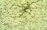 Tallo endofita in Lomentaria sp
